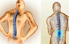 强直性脊柱炎能久坐吗