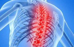 强直性脊柱炎能针灸吗